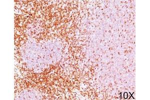 IHC testing of human tonsil stained with CD6 antibody (3F7B5).
