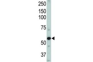 Western Blotting (WB) image for anti-Activin A Receptor Type II-Like 1 (ACVRL1) antibody (ABIN3003504) (ACVRL1 antibody)