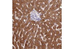 Immunohistochemical staining of human liver with PPP4R4 polyclonal antibody  shows strong cytoplasmic positivity in hepatocytes at 1:200-1:500 dilution.