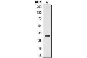 Western blot analysis of CYB5R3 expression in HeLa (A) whole cell lysates. (CYB5R3 antibody  (Center))