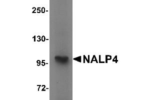 Western blot analysis of NALP4 in K562 cell lysate with NALP4 antibody at 1 µg/mL. (NLRP4 antibody  (Middle Region))