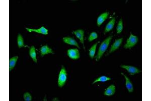 Immunofluorescent analysis of Hela cells using ABIN7157273 at dilution of 1:100 and Alexa Fluor 488-congugated AffiniPure Goat Anti-Rabbit IgG(H+L) (KLHL2 antibody  (AA 1-155))