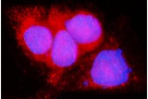 IF analysis of LACTB using anti-LACTB antibody (ABIN7600047). (LACTB antibody  (AA 141-543))
