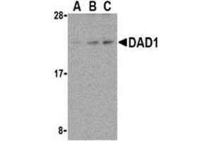 Western blot analysis of DAD1 in HepG2 cell lysate with AP30271PU-N DAD1 antibody at (A) 0. (DAD1 antibody)