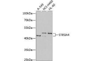 Western blot analysis of extracts of various cell lines, using ST8SI Antibody (ABIN6132840, ABIN6148545, ABIN6148546 and ABIN6222487) at 1:1000 dilution. (ST8SIA4 antibody  (AA 20-168))