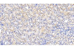 Detection of MCP1 in Mouse Kidney Tissue using Polyclonal Antibody to Monocyte Chemotactic Protein 1 (MCP1) (CCL2 antibody  (AA 24-96))