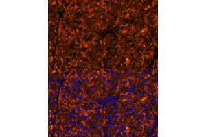 Immunofluorescence (IF) image for anti-serpin Peptidase Inhibitor, Clade I (Pancpin), Member 2 (SERPINI2) (AA 56-405) antibody (ABIN6147617)
