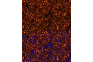 Immunofluorescence analysis of mouse pancreas using SERPINI2 Polyclonal Antibody (ABIN6131321, ABIN6147617, ABIN6147618 and ABIN6215429) at dilution of 1:100 (40x lens). (SERPINI2 antibody  (AA 56-405))