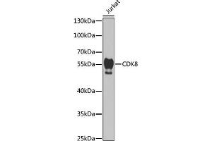 Western blot analysis of extracts of Jurkat cells, using CDK8 antibody (ABIN6129240, ABIN6138329, ABIN6138330 and ABIN7101776) at 1:1000 dilution. (CDK8 antibody  (AA 365-464))