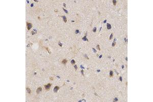 Immunohistochemistry of paraffin-embedded rat brain using PPP2R4 Antibody (ABIN5970981) at dilution of 1/200 (40x lens). (PPP2R4 antibody)