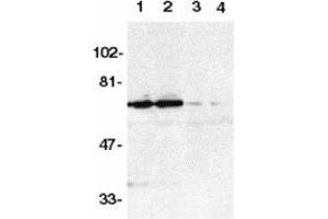Western blot analysis of DR6 in K562 (1,3) and Raji (2,4) whole cell lysate in the absence (1,2) or presence (3,4) of blocking peptide with AP30301PU-N DR6 antibody at 1/500 dilution.