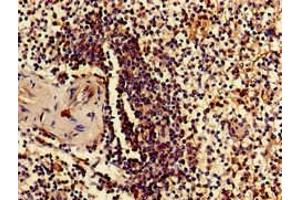 Immunohistochemistry of paraffin-embedded human spleen tissue using ABIN7142496 at dilution of 1:100 (RPS15 antibody  (AA 63-137))