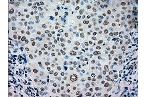 Image no. 2 for anti-TYRO3 Protein Tyrosine Kinase (TYRO3) antibody (ABIN1501607) (TYRO3 antibody)