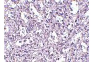 Immunohistochemistry of Carabin in human spleen tissue with Carabin antibody at 2. (Carabin antibody  (C-Term))