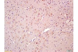 Formalin-fixed and paraffin embedded rat brain labeled with Anti-CNTF Polyclonal Antibody, Unconjugated (ABIN674229) at 1:200 followed by conjugation to the secondary antibody and DAB staining
