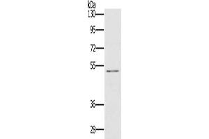 Gel: 8 % SDS-PAGE, Lysate: 40 μg, Lane: HT29 cells, Primary antibody: ABIN7129785(HTR3C Antibody) at dilution 1/500, Secondary antibody: Goat anti rabbit IgG at 1/8000 dilution, Exposure time: 20 seconds
