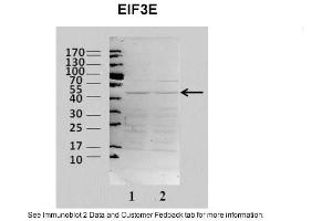 Sample Type: 2. (EIF3E antibody  (N-Term))