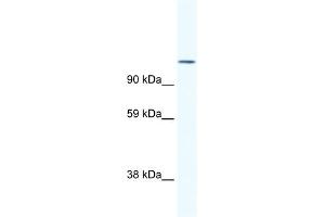 WB Suggested Anti-NFATC2 Antibody Titration:  1. (NFAT1 antibody  (N-Term))