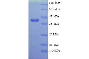 SDS-PAGE (SDS) image for Homocysteine S-Methyltransferase 1 (MHT1) (AA 1-324), (full length) protein (His tag) (ABIN5712896)