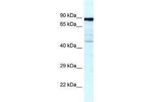 Western Blot showing CKAP2 antibody used at a concentration of 1 ug/ml against Fetal Lung Lysate (CKAP2 antibody  (C-Term))