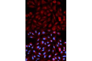 Immunofluorescence analysis of HeLa cells using PSME3 antibody. (PSME3 antibody)