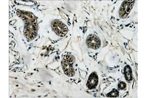 IHC Staining of Human colon tissue, diluted at 1:200. (TUBB3 antibody)