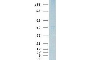 Validation with Western Blot