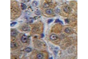 Used in DAB staining on fromalin fixed paraffin-embedded Liver tissue (aHSP antibody  (AA 1-102))