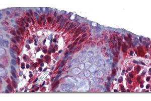 human Colon (RBM47 antibody  (Middle Region))