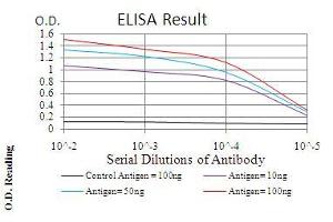 Black line: Control Antigen (100 ng), Purple line: Antigen(10 ng), Blue line: Antigen (50 ng), Red line: Antigen (100 ng), (TERT antibody  (AA 1029-1132))