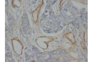 Image no. 1 for anti-Collagen, Type IV (COL4) antibody (Magnetic Particles) (ABIN1496273) (Collagen IV antibody  (Magnetic Particles))