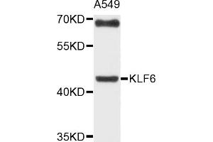 Western blot analysis of extracts of A-549 cells, using KLF6 antibody (ABIN4904165) at 1:1000 dilution. (KLF6 antibody)