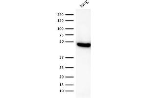 Western Blot Analysis of human lung lysate using CK19 Mouse Recombinant Monoclonal Antibody (rKRT19/800). (Recombinant Cytokeratin 19 antibody)