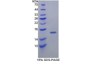 SDS-PAGE analysis of Guinea Pig Transthyretin Protein. (TTR Protein)
