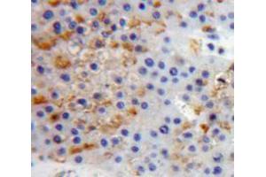 IHC-P analysis of Liver tissue, with DAB staining. (PTPRS antibody  (AA 77-361))