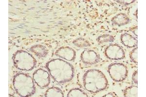 Immunohistochemistry of paraffin-embedded human colon tissue using ABIN7143116 at dilution of 1:100