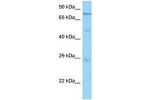 Image no. 1 for anti-Proteasome (Prosome, Macropain) 26S Subunit, ATPase, 1 (PSMC1) (AA 71-120) antibody (ABIN6748218) (PSMC1 antibody  (AA 71-120))