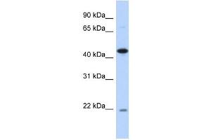 NOB1 antibody used at 1 ug/ml to detect target protein. (NOB1 antibody)
