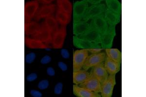 ABIN6266202 and ABIN6277355 staining Hela cells(30 min of UV treatment) by IF/ICC. (Dopamine Receptor d1 antibody  (N-Term))