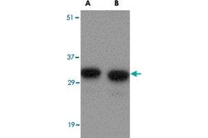 Western blot analysis of NIPSNAP1 in human brain tissue lysate with NIPSNAP1 polyclonal antibody  at (A) 0. (NIPSNAP1 antibody  (Internal Region))