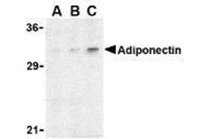 Western blot analysis of adiponectin in rat brain cell lysate with AP30023PU-N adiponectin antibody at (A) 1, (B) 2, and (C) 4 μg/ml.