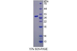SDS-PAGE analysis of Human TLR4 Protein.