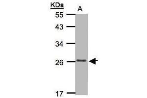 WB Image Sample(30 μg of whole cell lysate) A:MOLT4 whole cell lysate , 12% SDS PAGE antibody diluted at 1:1000
