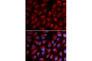 anti-Erythrocyte Membrane Protein Band 4.1 (Elliptocytosis 1, RH-Linked) (EPB41) (AA 210-500) antibody