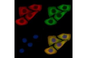 Phospho-Syntaxin 1A (Ser14) Mouse Monoclonal Antibody staining Hela cells by IF/ICC.