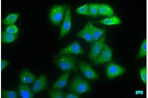 Immunofluorescence staining of Hela cells with ABIN7165849 at 1:66, counter-stained with DAPI. (NDRG1 antibody  (AA 136-394))