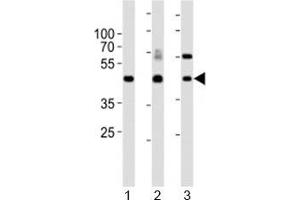 Western blot analysis of lysate from 1) mouse kidney, 2) mouse thymus and 3) rat lung tissue lysate using Dlk1 antibody.