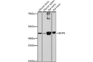 Western blot analysis of extracts of various cell lines, using DHPS antibody (ABIN6130951, ABIN6139591, ABIN6139592 and ABIN6221985) at 1:1000 dilution. (DHPS antibody  (AA 1-369))