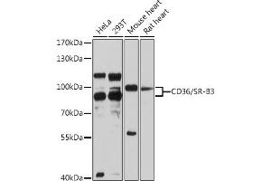 Western blot analysis of extracts of various cell lines, using CD36/SR-B3 antibody (ABIN3015504, ABIN3015505, ABIN1679086, ABIN5663919 and ABIN6218561) at 1:3000 dilution. (CD36 antibody  (AA 301-400))