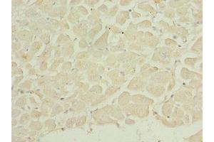 Immunohistochemistry of paraffin-embedded human heart tissue using ABIN7150764 at dilution of 1:100 (DUSP22 antibody  (AA 1-184))